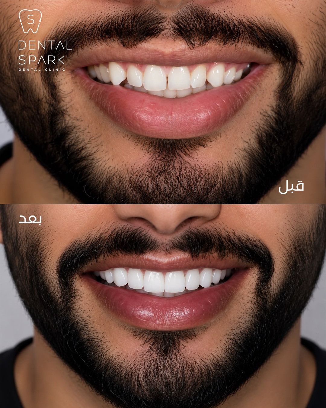 Before and After 3